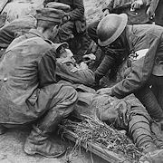 Wounded British Soldier
